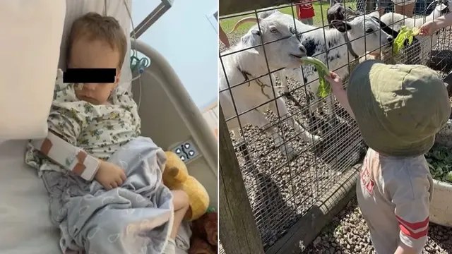 Dvojročný chlapček sa počas návštevy kontaktnej zoo nakazil nebezpečným kmeňom baktérie E.coli. 